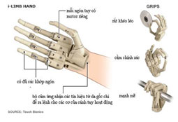 Cánh tay sinh học điện tử đoạt giải nhất công nghệ cơ khí